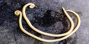 ascariasis.jpg