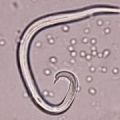 capillaris.jpg