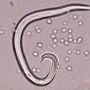capillaris.jpg
